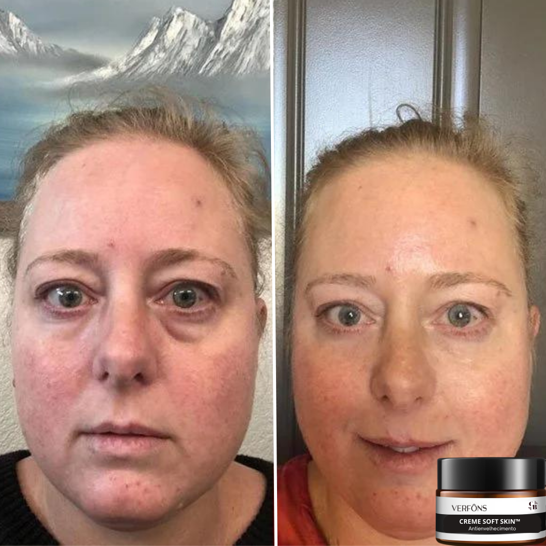 Creme Soft Skin - Antienvelhecimento - LAURA ROBERG