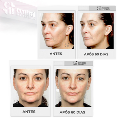 Massageador Facial de Microcorrente - FaceLift - LAURA ROBERG