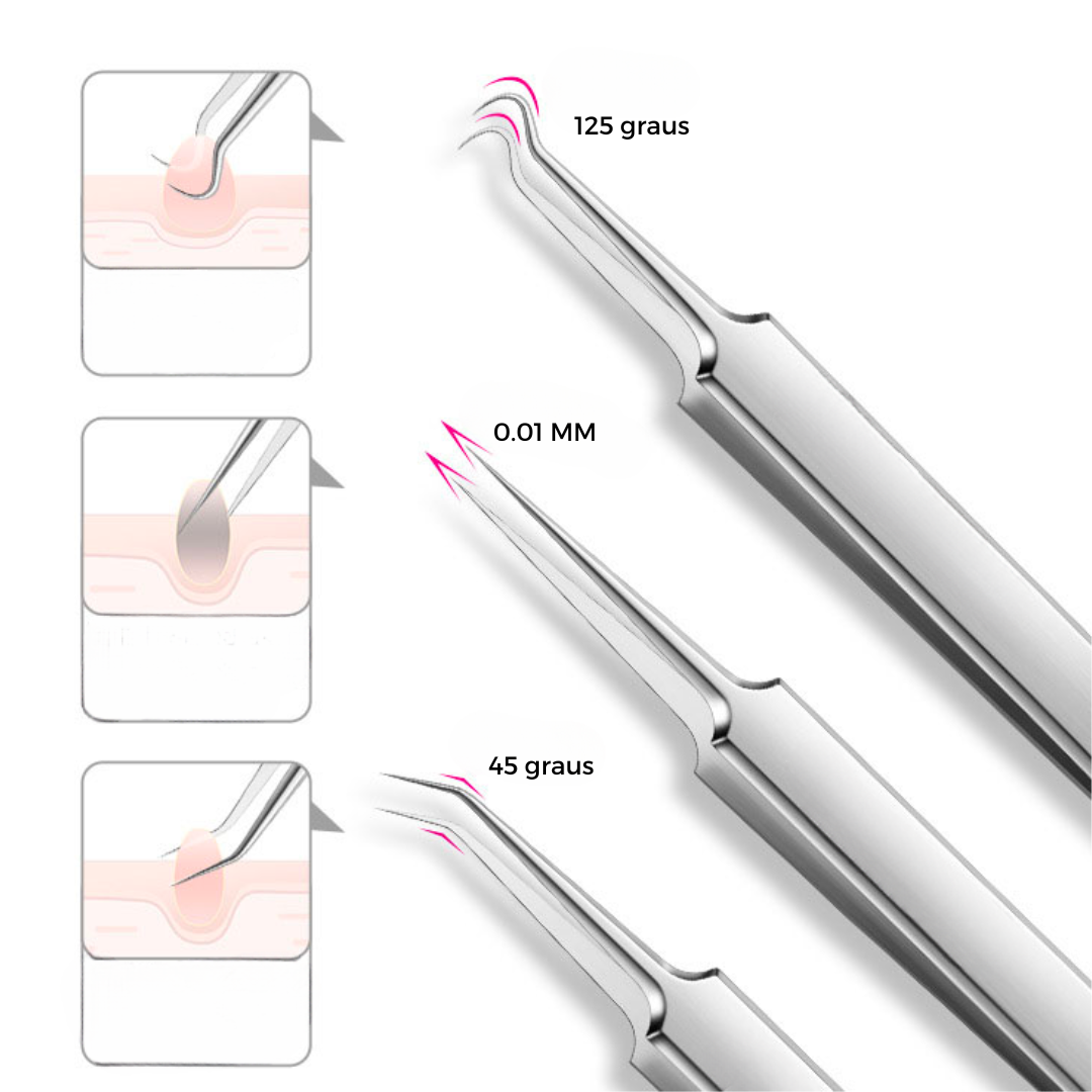 A PINÇA - LAURA ROBERG