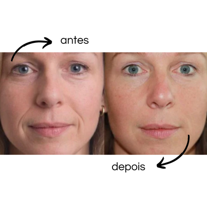 Flex Beauty - Patches reutilizáveis de silicone - LAURA ROBERG