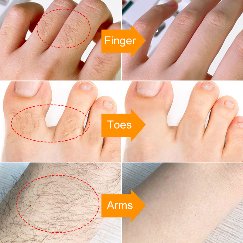 Creme Depilação Facial Indolor - SilkGlide - LAURA ROBERG