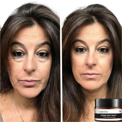 Creme Soft Skin - Antienvelhecimento - LAURA ROBERG