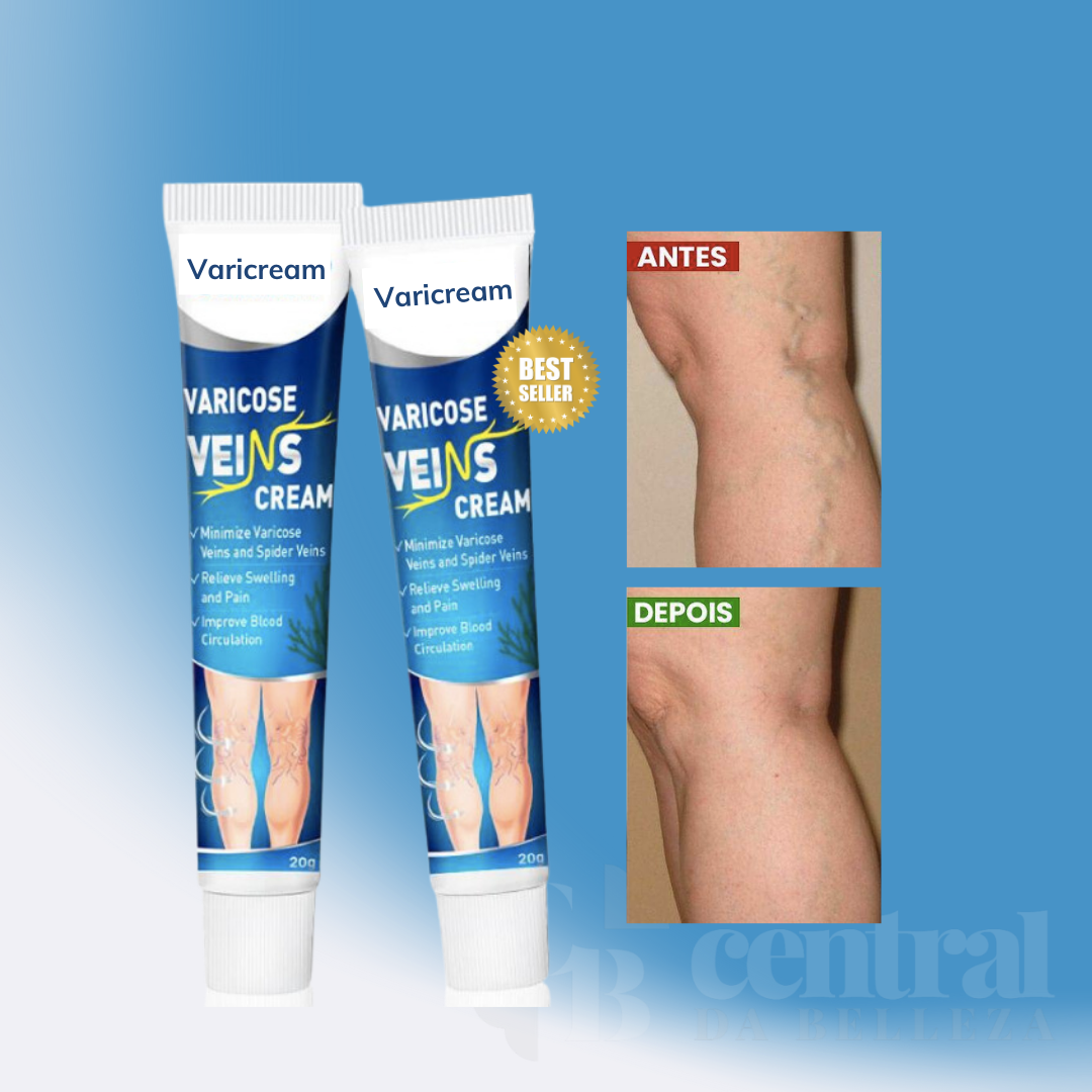 Varicream 3 em 1 - VARIZES, VASINHOS E INCHAÇOS! - LAURA ROBERG
