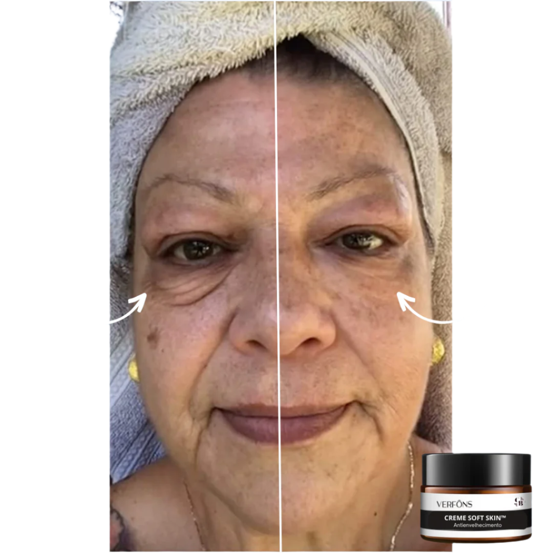 Creme Soft Skin - Antienvelhecimento - LAURA ROBERG