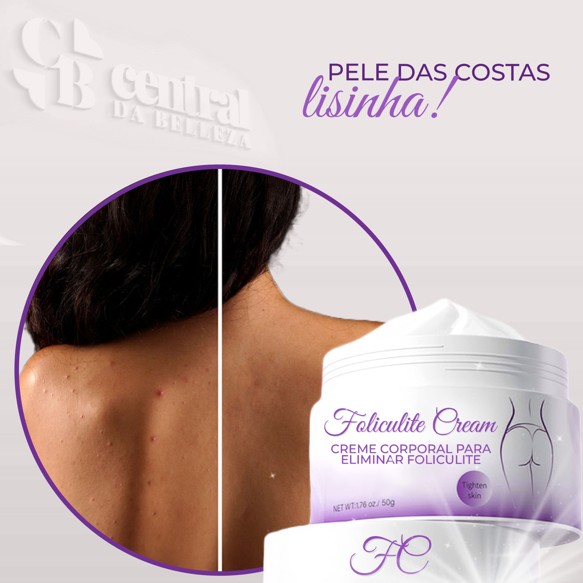 Folicure Cream - Creme Corporal para Foliculite - LAURA ROBERG
