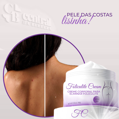 Folicure Cream - Creme Corporal para Foliculite - LAURA ROBERG