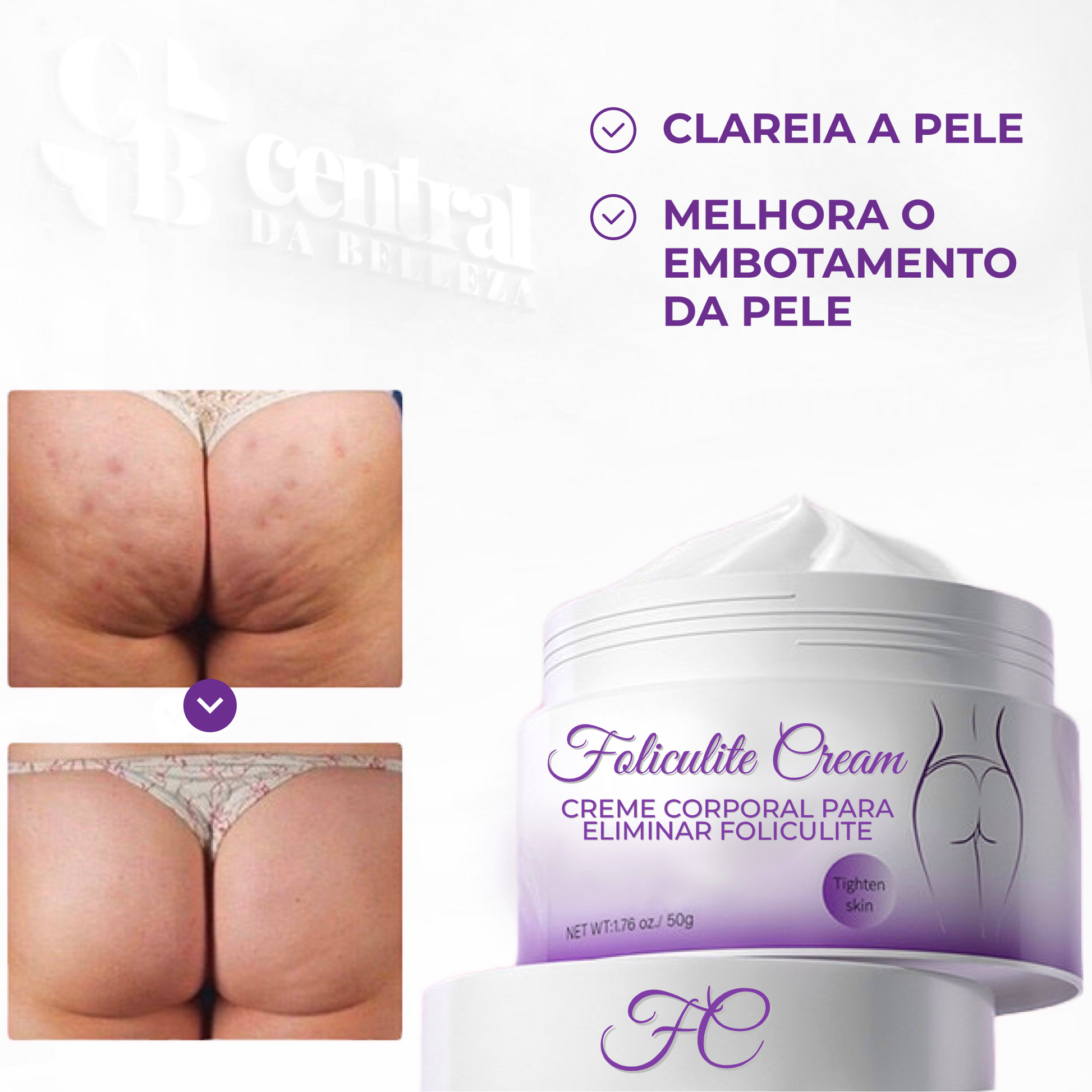 Folicure Cream - Creme Corporal para Foliculite - LAURA ROBERG