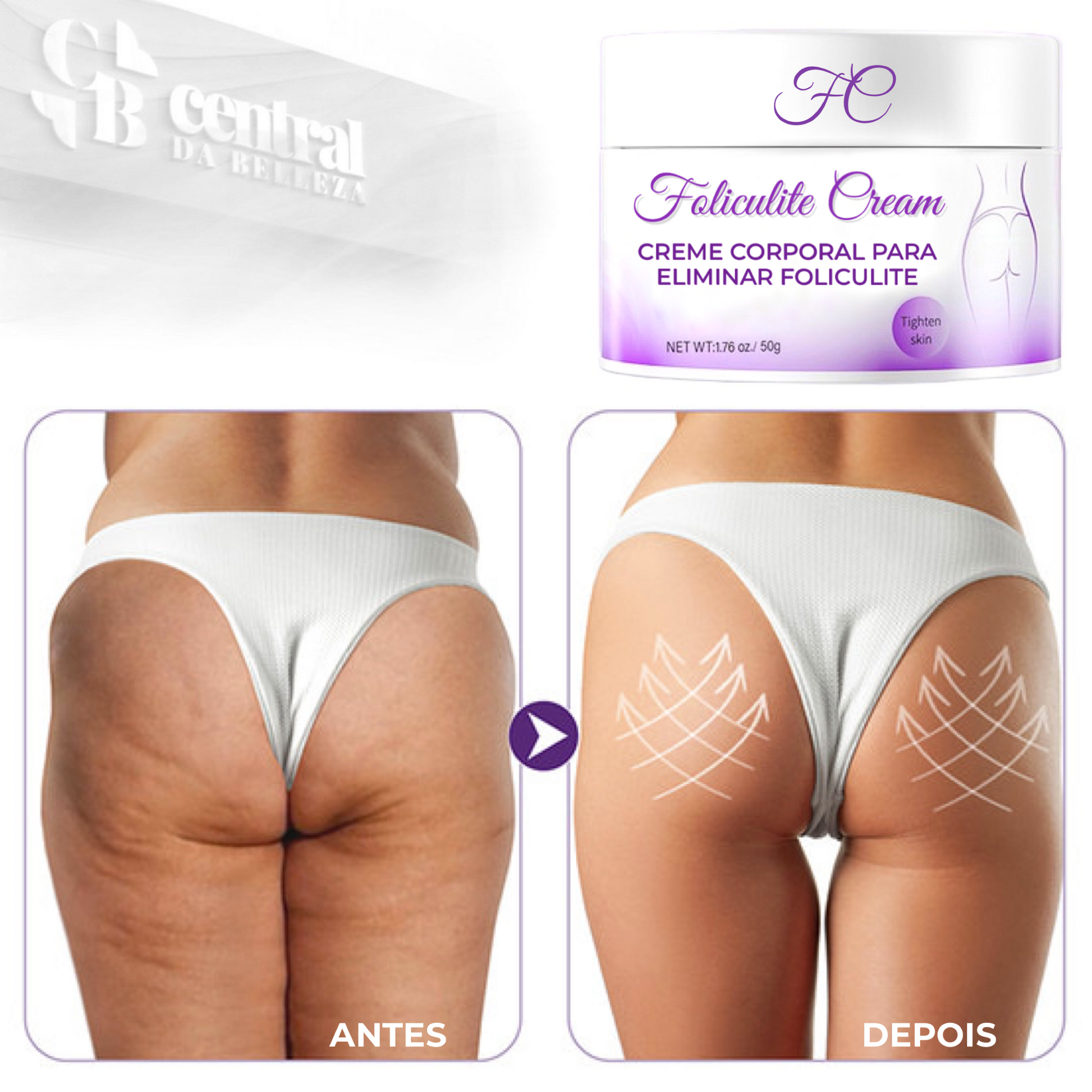 Folicure Cream - Creme Corporal para Foliculite - LAURA ROBERG