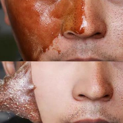 Golden Glow Mask - Elimina cravos e imperfeições - LAURA ROBERG