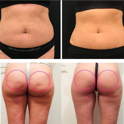LipoPower - Lipo Sem Cortes - LAURA ROBERG