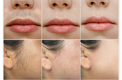 Creme Depilação Facial Indolor - SilkGlide - LAURA ROBERG