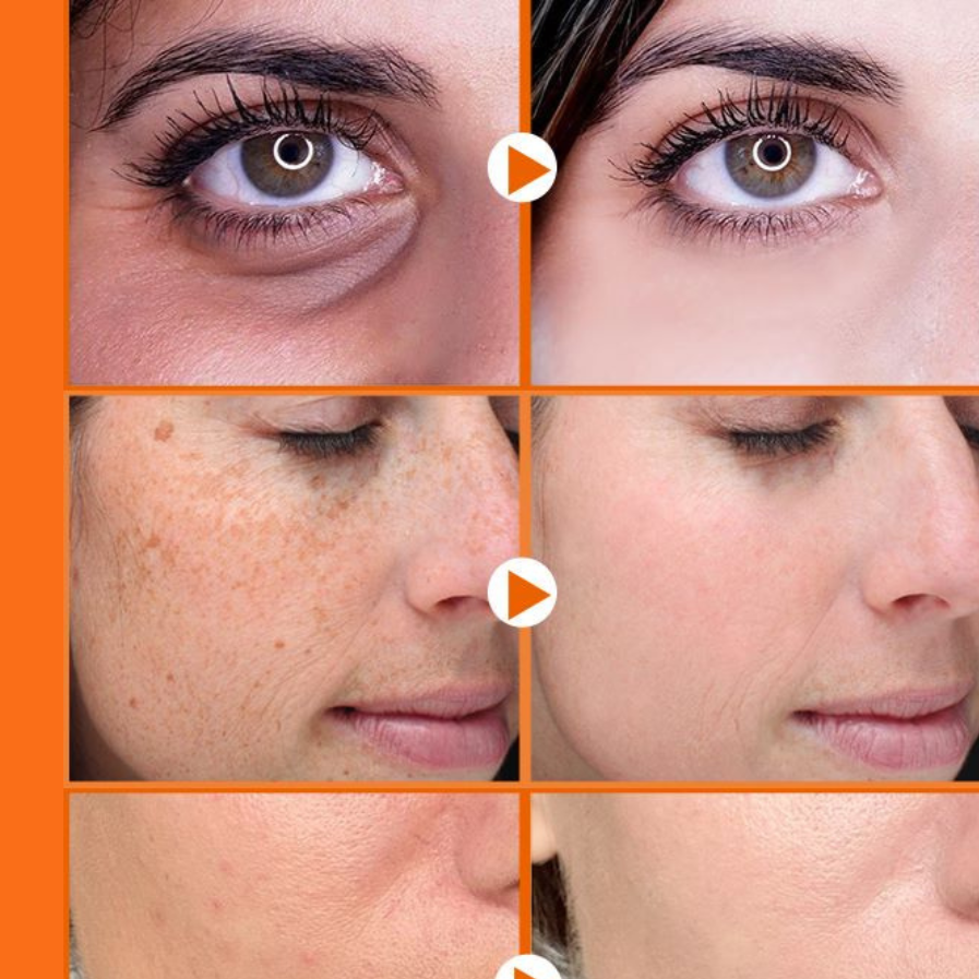 Sérum anti-idade Vitamina C - LAURA ROBERG