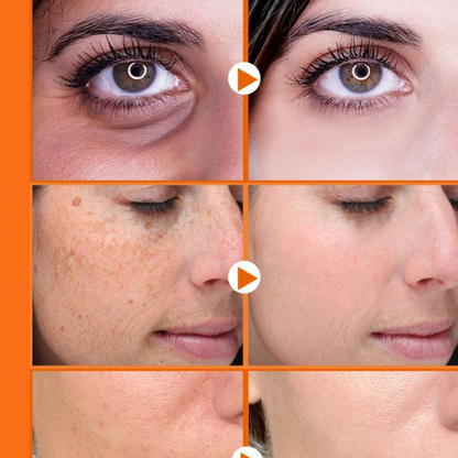 Sérum anti-idade Vitamina C - LAURA ROBERG