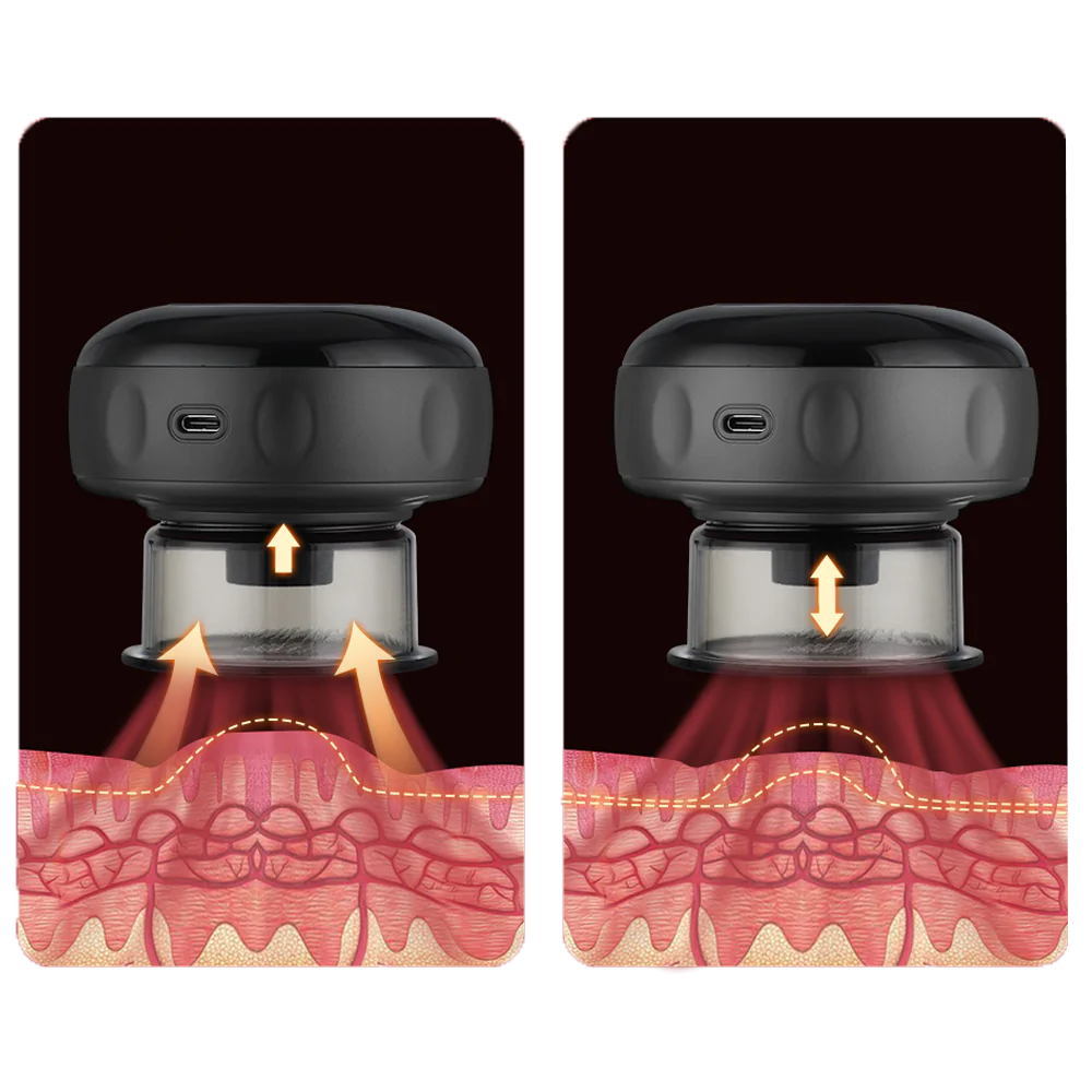 Smart Cupper Detox™ - LAURA ROBERG